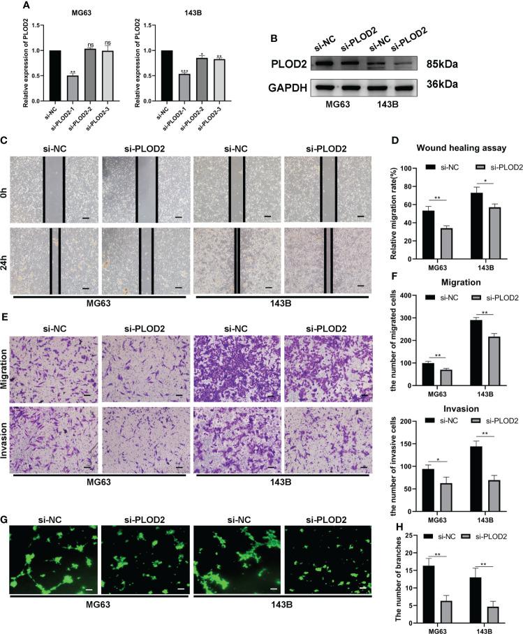https://cdn.ncbi.nlm.nih.gov/pmc/blobs/eb53/9581331/7f78334389ee/fonc-12-980390-g002.jpg