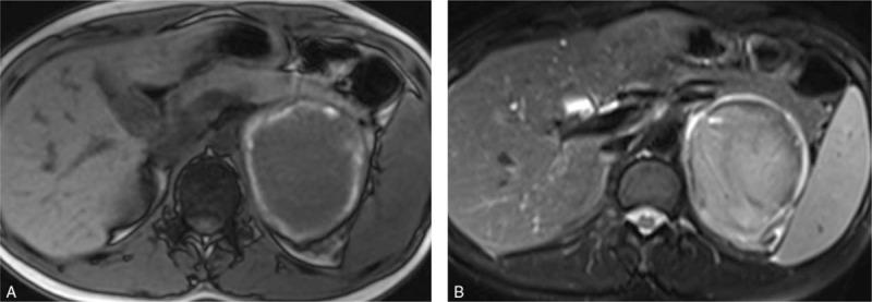 https://cdn.ncbi.nlm.nih.gov/pmc/blobs/eb62/6392740/1060c120d2b2/medi-97-e13329-g001.jpg