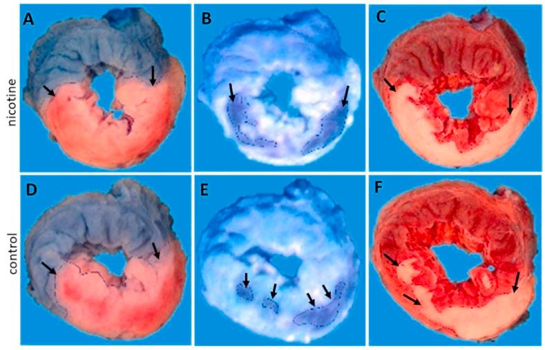https://cdn.ncbi.nlm.nih.gov/pmc/blobs/eb62/7680768/c80544ebaef2/gr2.jpg