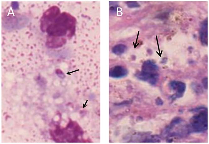 https://cdn.ncbi.nlm.nih.gov/pmc/blobs/eb6f/4786339/18db1b7eede1/pntd.0004388.g002.jpg