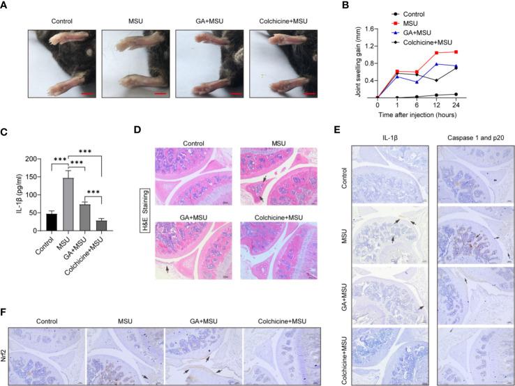 https://cdn.ncbi.nlm.nih.gov/pmc/blobs/eb6f/7750458/ea54261bc48b/fimmu-11-580593-g006.jpg