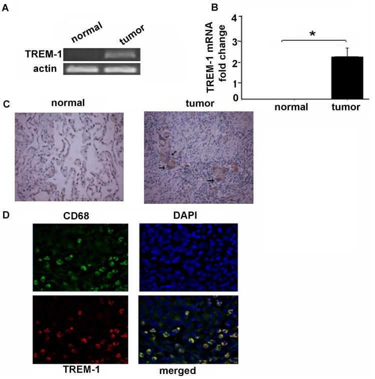 https://cdn.ncbi.nlm.nih.gov/pmc/blobs/eb71/4026315/a0482b38b641/pone.0094241.g001.jpg
