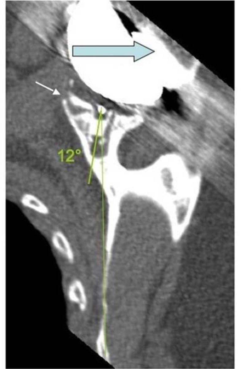 https://cdn.ncbi.nlm.nih.gov/pmc/blobs/eb71/5676001/a744685b75dc/TOORTHJ-11-1133_F4.jpg