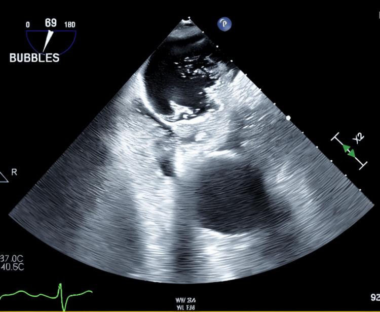 https://cdn.ncbi.nlm.nih.gov/pmc/blobs/eb72/12233993/8233ee608cba/cureus-0017-00000085518-i03.jpg