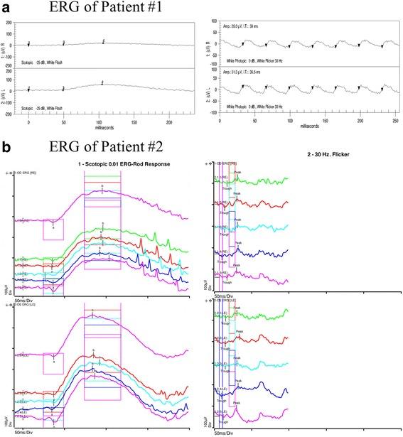 https://cdn.ncbi.nlm.nih.gov/pmc/blobs/eb80/5702215/3c2ad1c6b390/12886_2017_615_Fig2_HTML.jpg