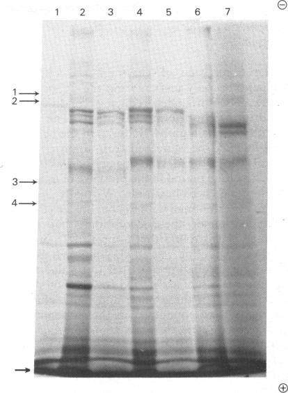 https://cdn.ncbi.nlm.nih.gov/pmc/blobs/eb83/1144740/25e53f33528b/biochemj00308-0187-b.jpg
