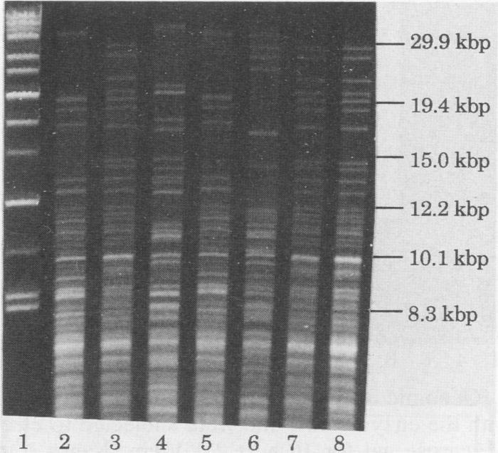 https://cdn.ncbi.nlm.nih.gov/pmc/blobs/eb83/265555/3ae1aa341879/jcm00018-0039-b.jpg