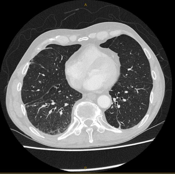 https://cdn.ncbi.nlm.nih.gov/pmc/blobs/eb8b/11164566/492fc39e601d/RCR2-12-e01408-g001.jpg