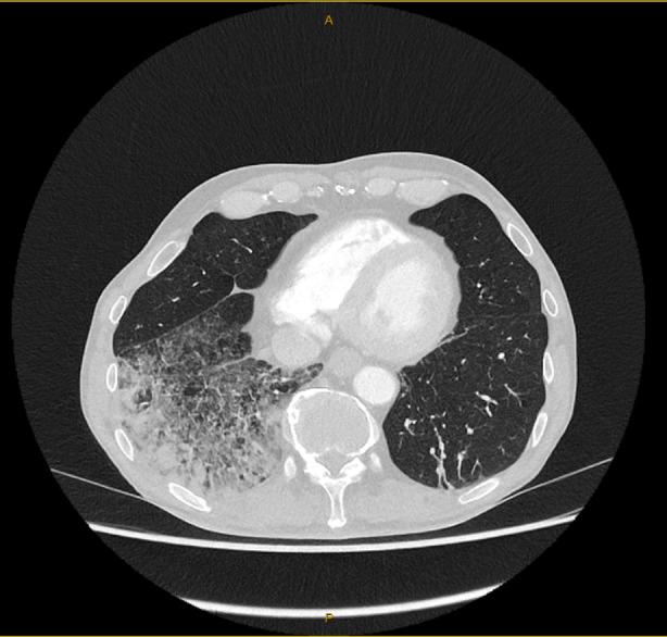 https://cdn.ncbi.nlm.nih.gov/pmc/blobs/eb8b/11164566/4b6ac54562b8/RCR2-12-e01408-g002.jpg