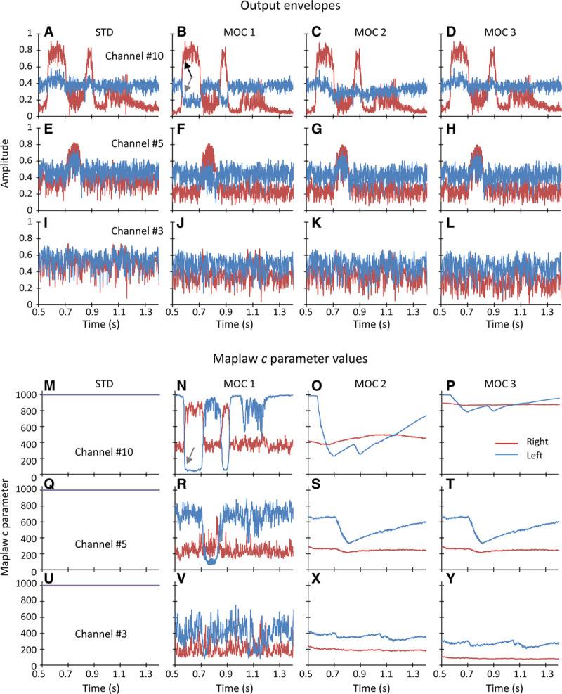 https://cdn.ncbi.nlm.nih.gov/pmc/blobs/eb9e/7722463/7b08b78b1c80/aud-41-1492-g003.jpg
