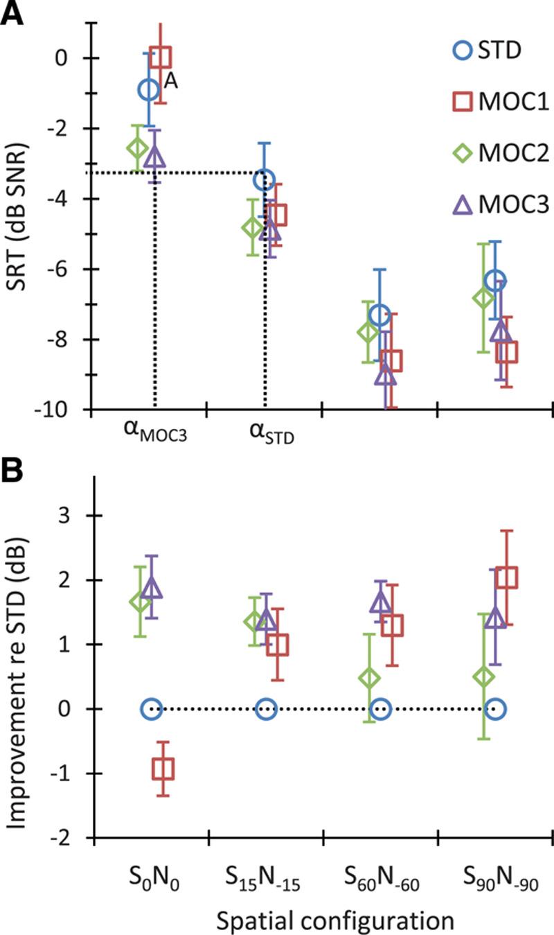 https://cdn.ncbi.nlm.nih.gov/pmc/blobs/eb9e/7722463/8d5d28620143/aud-41-1492-g010.jpg