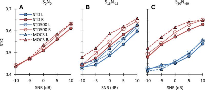 https://cdn.ncbi.nlm.nih.gov/pmc/blobs/eb9e/7722463/8ff372d3eece/aud-41-1492-g012.jpg
