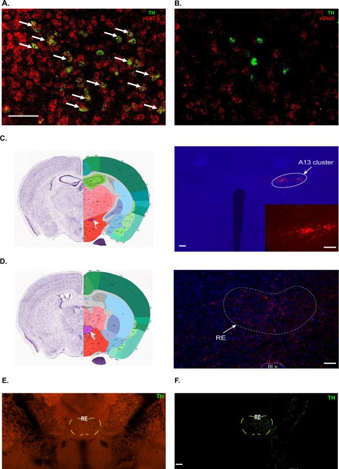 https://cdn.ncbi.nlm.nih.gov/pmc/blobs/eb9f/8280196/2bba8173a480/41386_2021_1006_Fig3_HTML.jpg