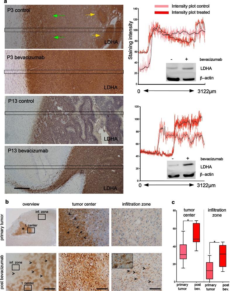 https://cdn.ncbi.nlm.nih.gov/pmc/blobs/eba6/4282692/f8f48ee50105/401_2014_1352_Fig5_HTML.jpg