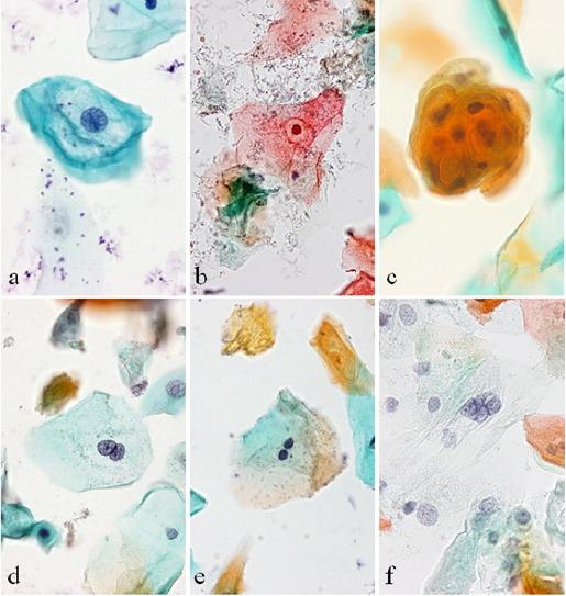 https://cdn.ncbi.nlm.nih.gov/pmc/blobs/eba7/5773808/f7e916cc58f1/APJCP-18-3173-g001.jpg