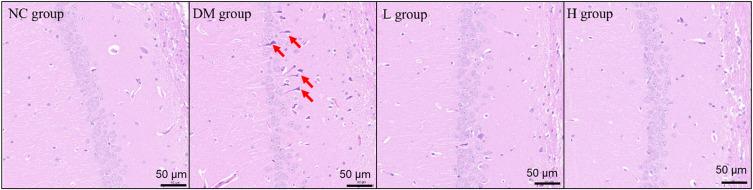 https://cdn.ncbi.nlm.nih.gov/pmc/blobs/ebaa/10069430/45a033721013/DMSO-16-901-g0003.jpg