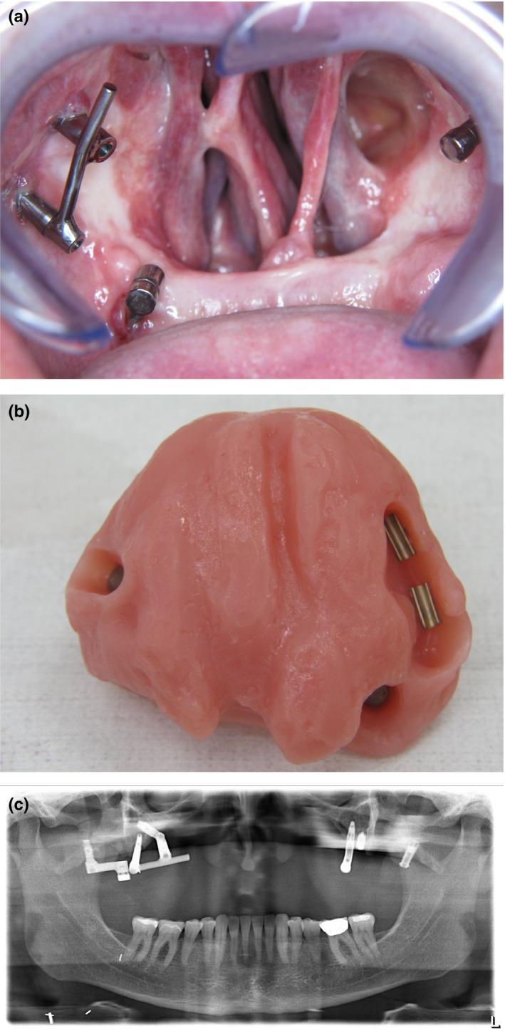https://cdn.ncbi.nlm.nih.gov/pmc/blobs/ebad/7319476/677a21c4f81b/CLR-31-405-g001.jpg