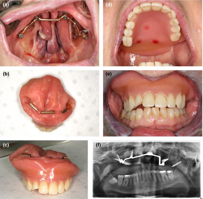 https://cdn.ncbi.nlm.nih.gov/pmc/blobs/ebad/7319476/baaf828c3625/CLR-31-405-g002.jpg