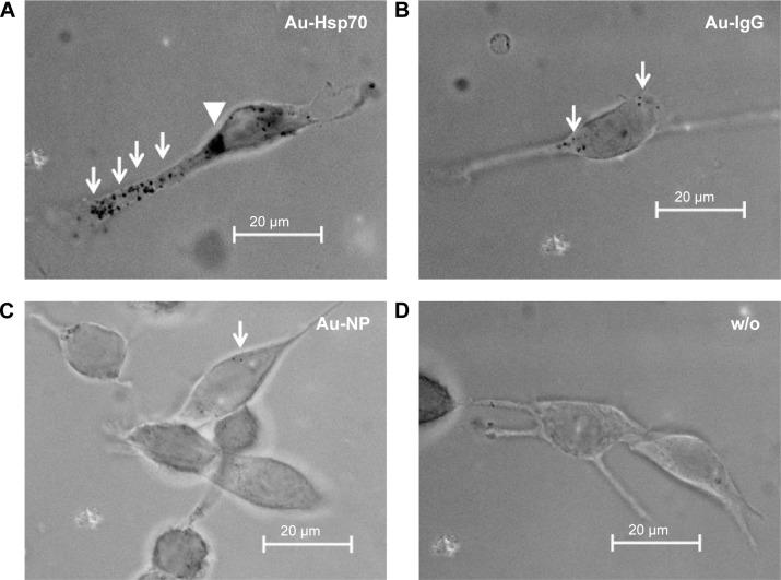 https://cdn.ncbi.nlm.nih.gov/pmc/blobs/ebb1/4572731/67d965600429/ijn-10-5687Fig2.jpg