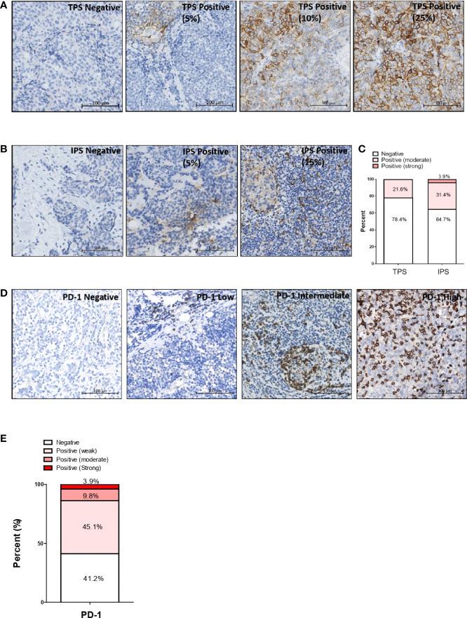 https://cdn.ncbi.nlm.nih.gov/pmc/blobs/ebbe/9531766/409d0490f4c2/fonc-12-917743-g001.jpg