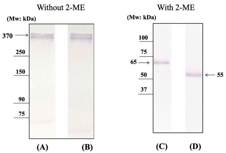 https://cdn.ncbi.nlm.nih.gov/pmc/blobs/ebc0/7916671/b916fc710d9b/ijms-22-01766-g002.jpg