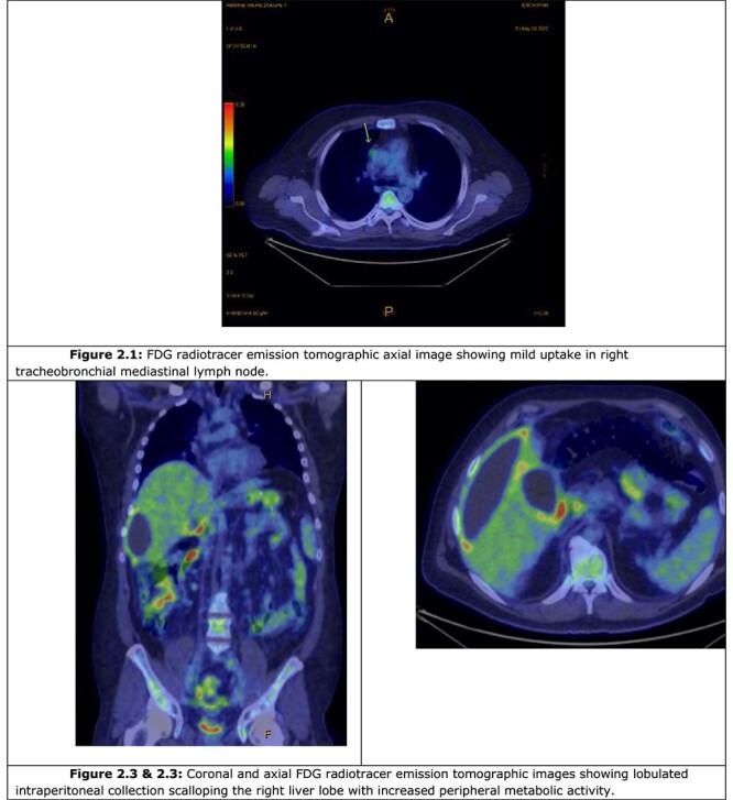 https://cdn.ncbi.nlm.nih.gov/pmc/blobs/ebc7/10276982/b28f88ee81db/rjad308f2.jpg