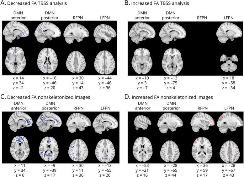 https://cdn.ncbi.nlm.nih.gov/pmc/blobs/ebc8/8601205/98866ff7dedb/NEUROLOGY2021171238F3.jpg