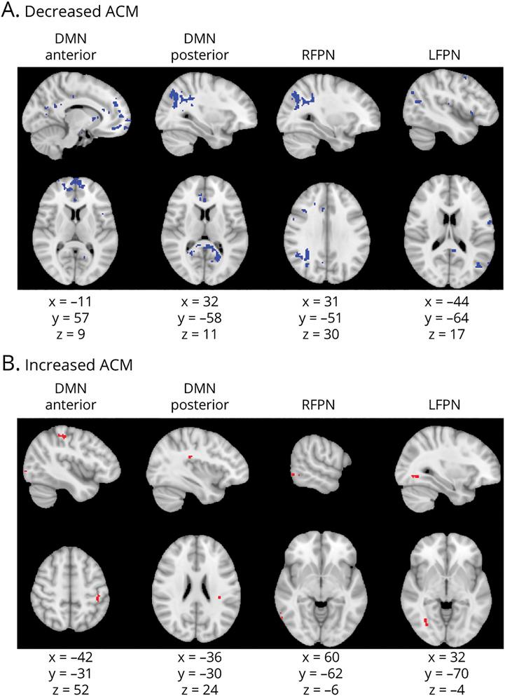 https://cdn.ncbi.nlm.nih.gov/pmc/blobs/ebc8/8601205/c91ef51f9eb6/NEUROLOGY2021171238F2.jpg