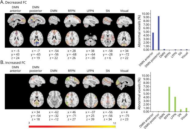 https://cdn.ncbi.nlm.nih.gov/pmc/blobs/ebc8/8601205/d69c561b18f1/NEUROLOGY2021171238F1.jpg
