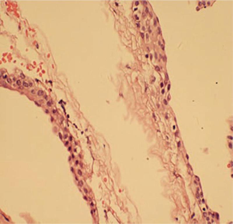 https://cdn.ncbi.nlm.nih.gov/pmc/blobs/ebcd/6709100/7b48643dbaff/medi-98-e16650-g002.jpg