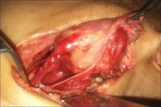 https://cdn.ncbi.nlm.nih.gov/pmc/blobs/ebd9/5341630/74cf935ccc9f/AER-11-254-g002.jpg