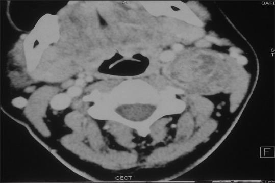 https://cdn.ncbi.nlm.nih.gov/pmc/blobs/ebd9/5341630/8599f85a3fb3/AER-11-254-g001.jpg