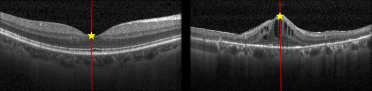 https://cdn.ncbi.nlm.nih.gov/pmc/blobs/ebde/11125471/febf370654b0/pone.0304146.g008.jpg