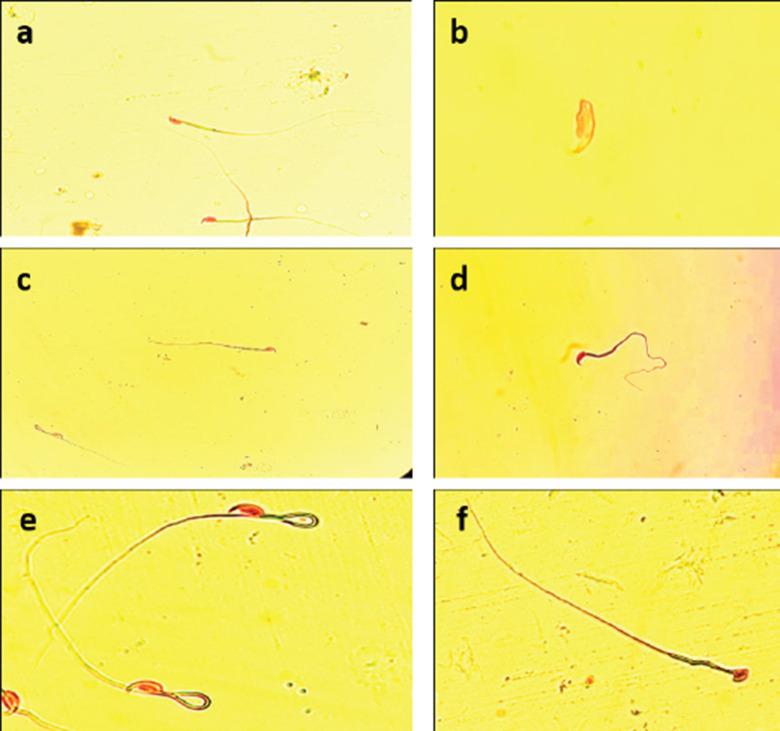 https://cdn.ncbi.nlm.nih.gov/pmc/blobs/ebe0/9109838/4090c69579f2/OpenVetJ-12-165-g001.jpg