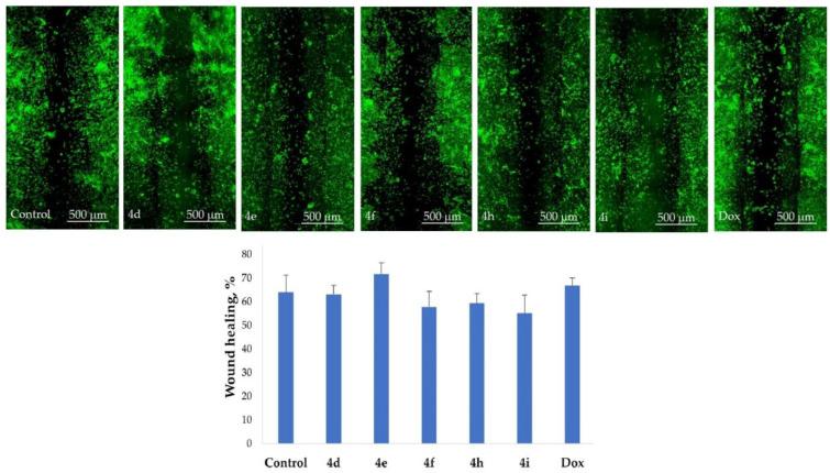 https://cdn.ncbi.nlm.nih.gov/pmc/blobs/ebec/9506420/f518a6f1b4aa/ijms-23-10759-g013.jpg