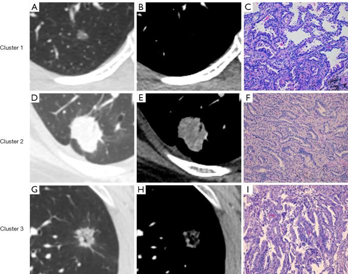 https://cdn.ncbi.nlm.nih.gov/pmc/blobs/ebed/11384472/3855264ad9b8/tlcr-13-08-1794-f3.jpg
