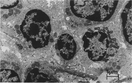 https://cdn.ncbi.nlm.nih.gov/pmc/blobs/ebf0/176340/044268168747/aac00177-0021-a.jpg