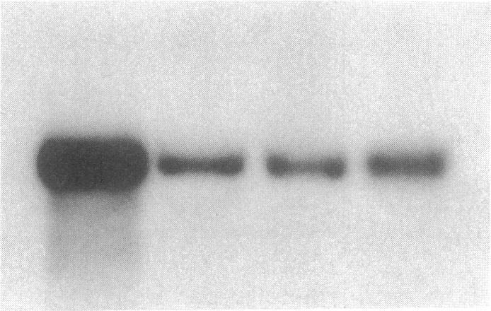 https://cdn.ncbi.nlm.nih.gov/pmc/blobs/ebf1/288182/2cb8d3b67e7f/jcinvest00040-0046-b.jpg