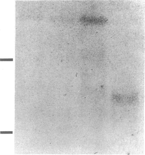 https://cdn.ncbi.nlm.nih.gov/pmc/blobs/ebf1/288182/7dc706e3fb72/jcinvest00040-0048-e.jpg