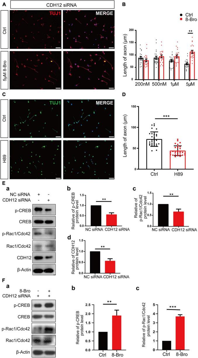 https://cdn.ncbi.nlm.nih.gov/pmc/blobs/ebf4/8606577/710495eff719/fcell-09-768970-g003.jpg