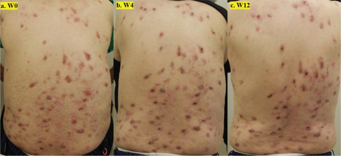 https://cdn.ncbi.nlm.nih.gov/pmc/blobs/ebf5/12186433/4c143e8cd57d/ActaDV-105-43419-g002.jpg