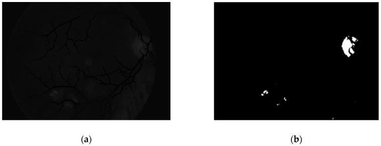 https://cdn.ncbi.nlm.nih.gov/pmc/blobs/ebf8/6387053/5b1e17465d4d/sensors-19-00695-g015.jpg