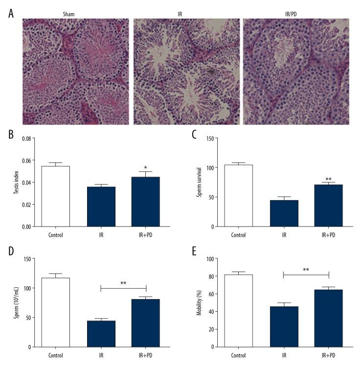 https://cdn.ncbi.nlm.nih.gov/pmc/blobs/ebfa/6299782/5b620be368fa/medscimonit-24-8993-g001.jpg
