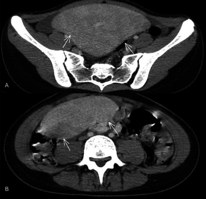 https://cdn.ncbi.nlm.nih.gov/pmc/blobs/ebfe/12221586/a5fe089dbaa4/gr1.jpg