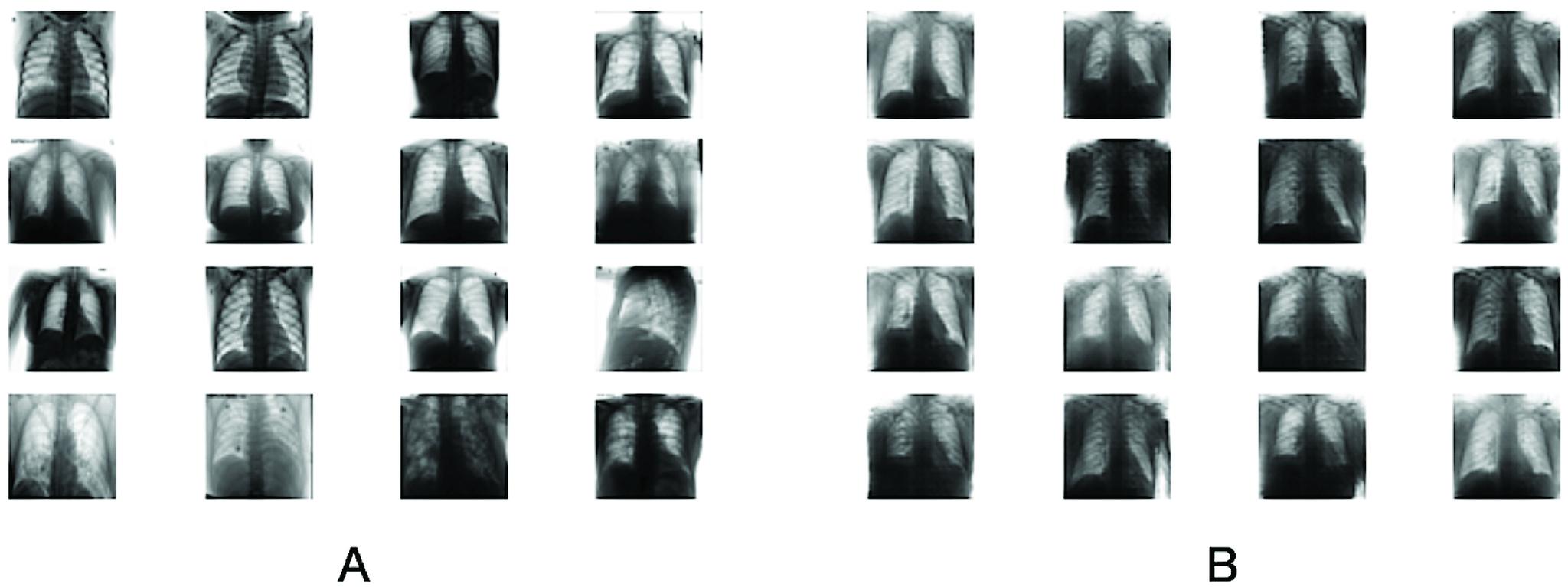 https://cdn.ncbi.nlm.nih.gov/pmc/blobs/ec01/8043420/2f65e5d81c36/gupta4ab-2994762.jpg