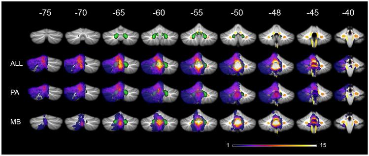 https://cdn.ncbi.nlm.nih.gov/pmc/blobs/ec01/8423645/8b62a03197e6/381_2021_5244_Fig1_HTML.jpg