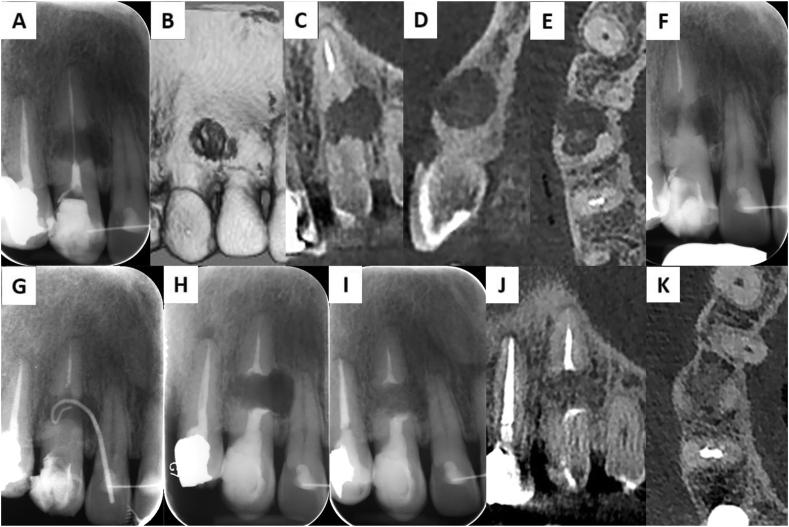https://cdn.ncbi.nlm.nih.gov/pmc/blobs/ec02/9236960/e992495fe006/gr1.jpg