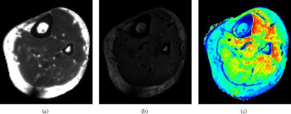 https://cdn.ncbi.nlm.nih.gov/pmc/blobs/ec04/10713252/0c5233f966b5/RRP2023-7412540.008.jpg