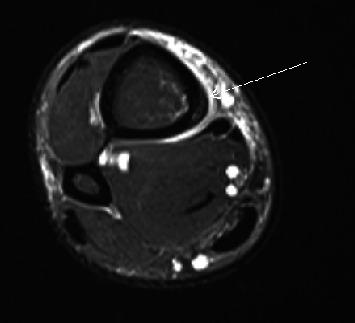 https://cdn.ncbi.nlm.nih.gov/pmc/blobs/ec04/10713252/acdf318c8e89/RRP2023-7412540.005.jpg