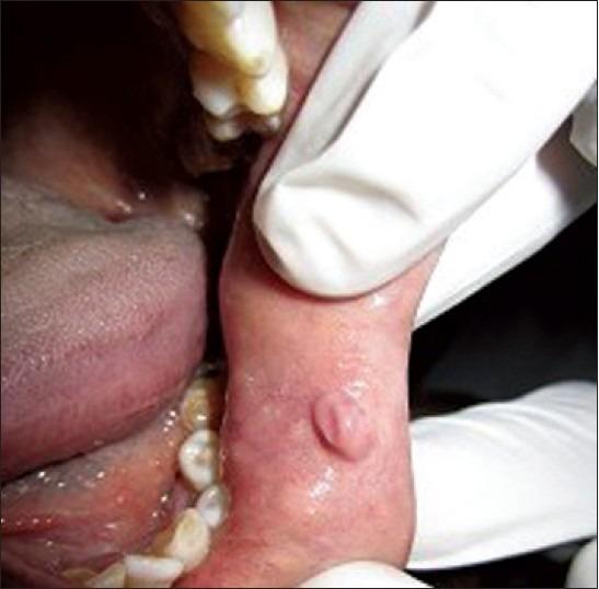 https://cdn.ncbi.nlm.nih.gov/pmc/blobs/ec05/3519210/ea74171772d9/JOMFP-16-359-g003.jpg